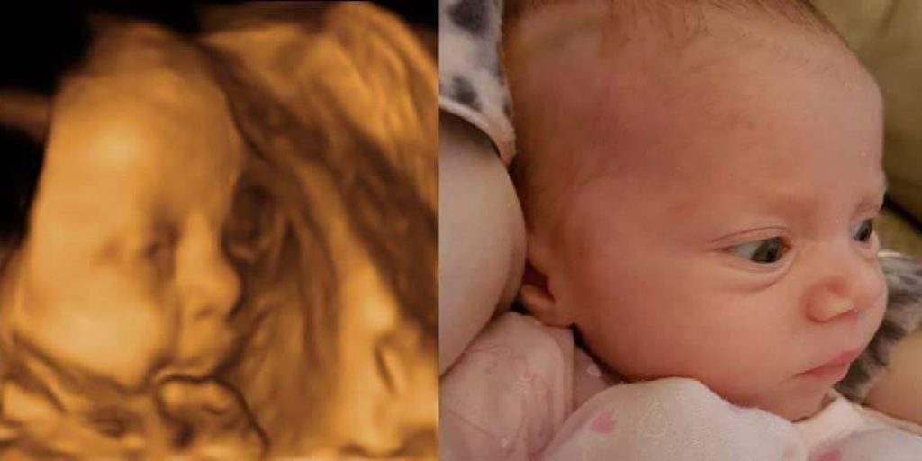 5 reasons you should have a 4D baby scan