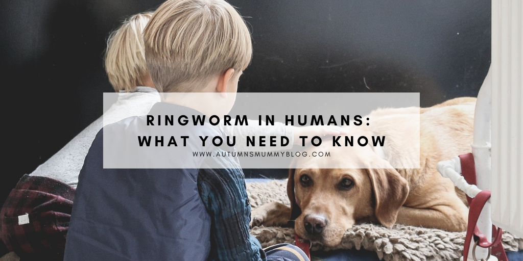 Ringworm In Humans: What You Need To Know
