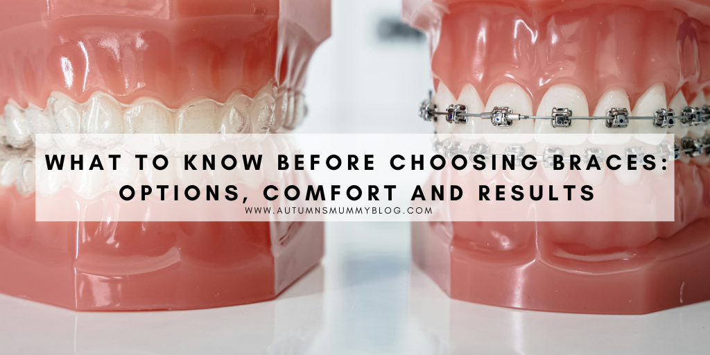 What to Know Before Choosing Braces: Options, Comfort and Results