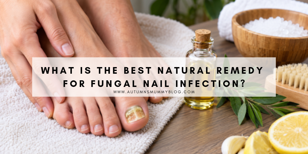 What Is the Best Natural Remedy for Fungal Nail Infection?